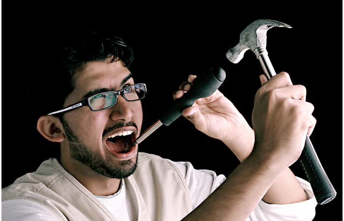 Answers to Questions you may Have about Dental Implants