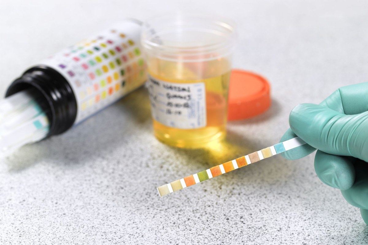 Working of Drug Urine Testing