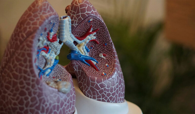Why Knowing the Early Signs of Lung Conditions Could Save a Loved One’s Life