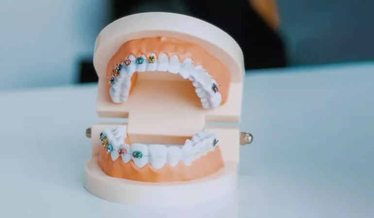 How Cosmetic Dentistry Boosts Confidence for Busy Parents