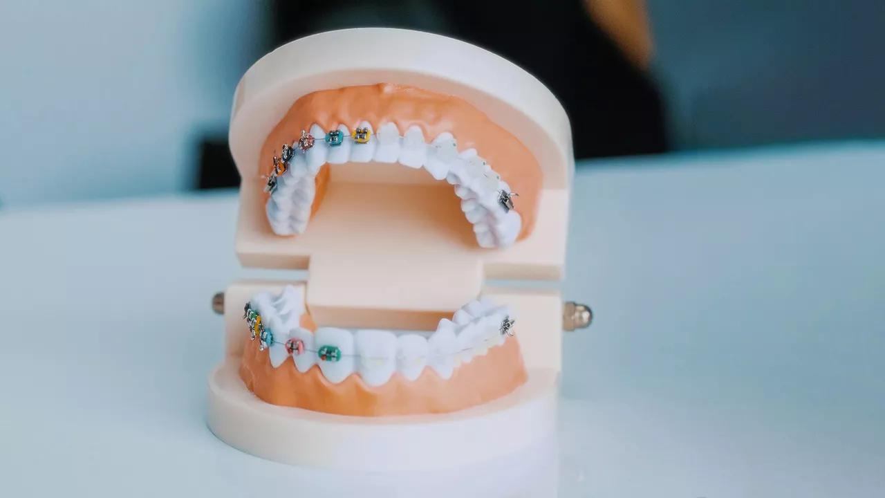 How Cosmetic Dentistry Boosts Confidence for Busy Parents